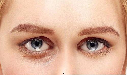 祛眼袋视频,祛眼袋视频全解析
